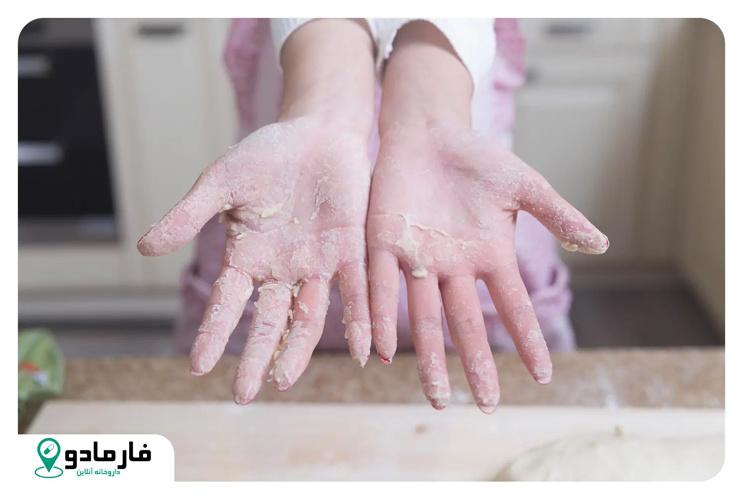 چگونه از پوسته‌پوسته شدن انگشت ها جلوگیری کنیم؟ روش‌های درمان