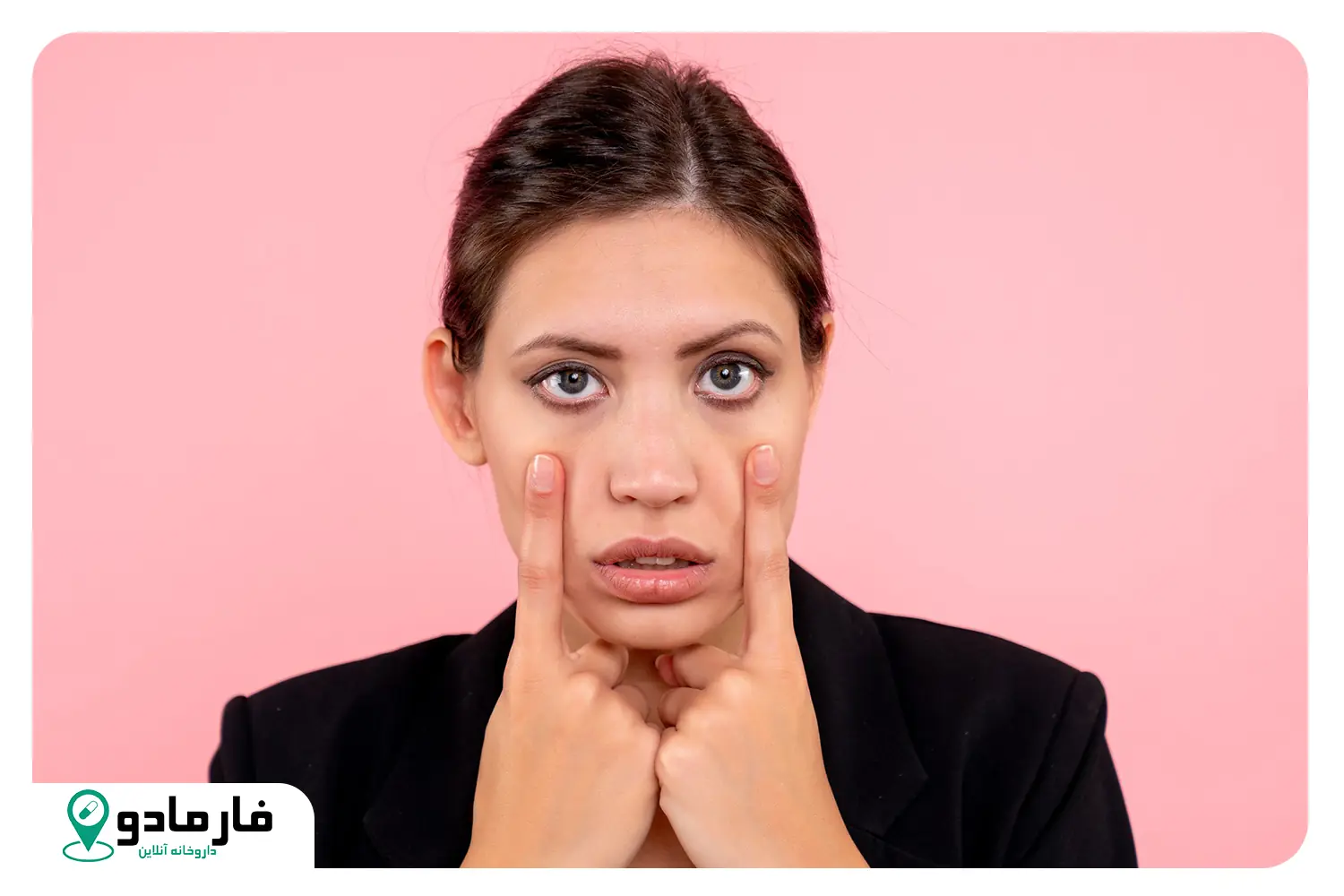 علت گودی زیر چشم و روش‌های درمان تیرگی زیر چشم